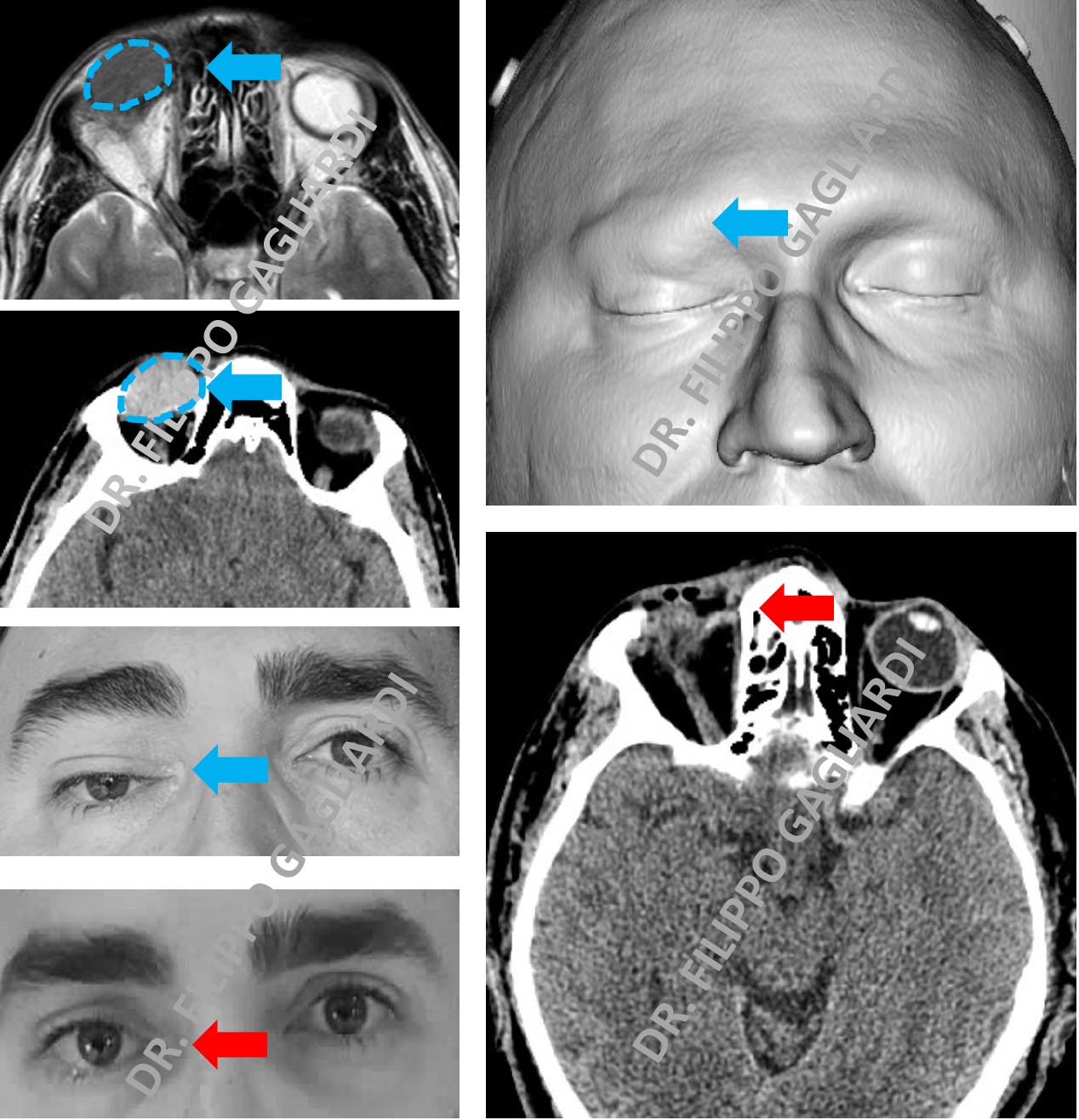 Chirurgia dell'orbita e dei seni paranasali